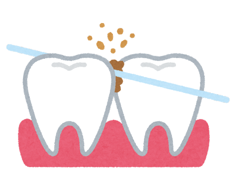 歯間ブラシやフロスは使っていますか？