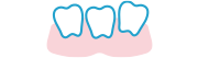 歯並びが気になる