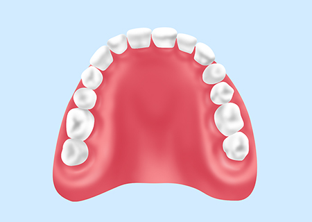 レジン床義歯（保険診療）